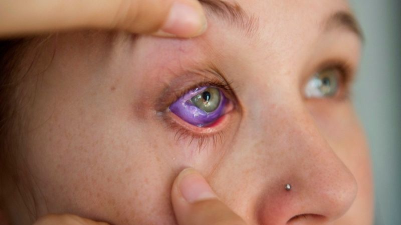 Eyeball tattoo